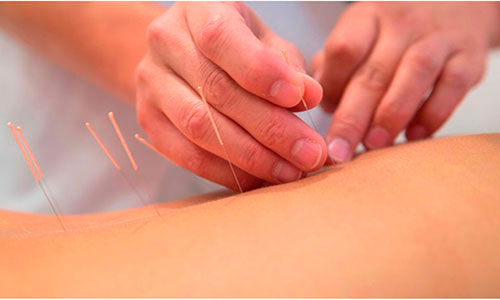 Знімаємо м'язову напругу