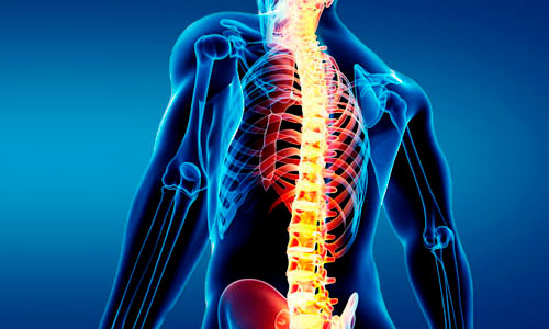 Міжхребетні грижі